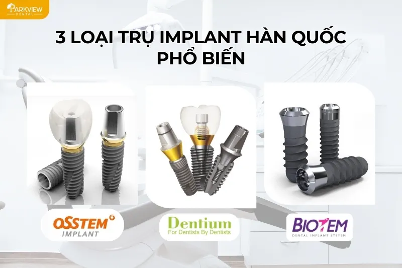 3 loại trụ Implant Hàn Quốc phổ biến