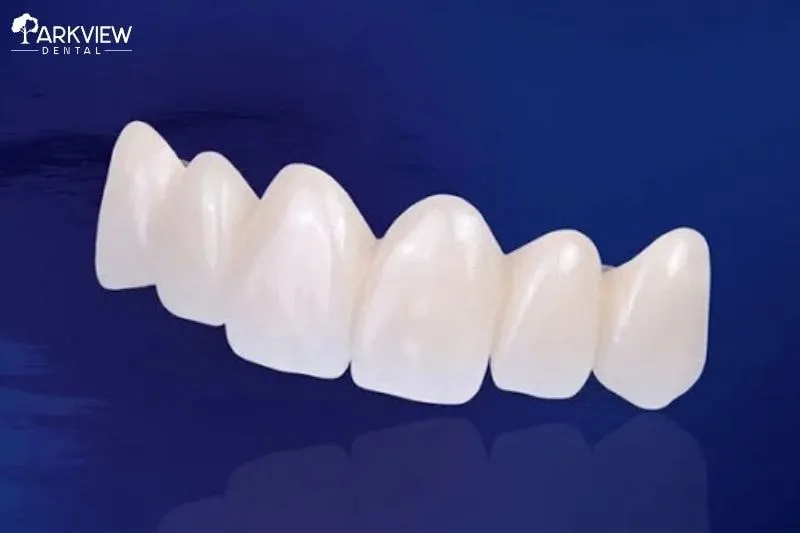 Sứ Lava giá bao nhiêu?