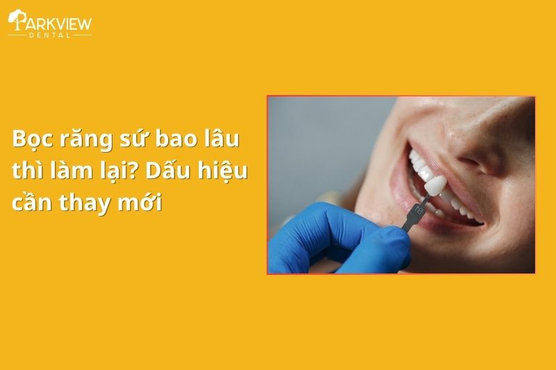 Bọc răng sứ bao lâu thì phải làm lại? Dấu hiệu cần thay mới