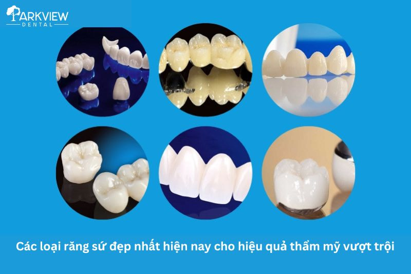 Các loại răng sứ đẹp nhất hiện nay