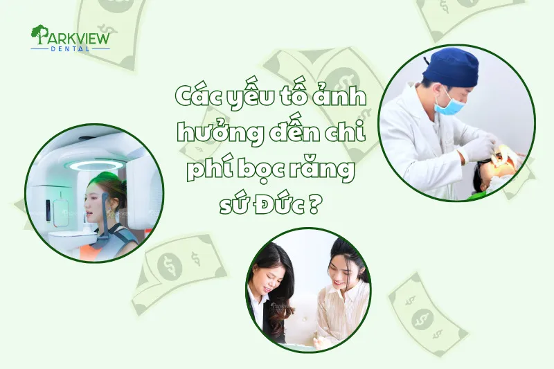 Các yếu tố ảnh hưởng đến chi phí bọc răng sứ Đức