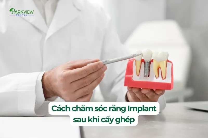 Cách chăm sóc răng implant sau khi cấy ghép
