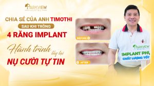 Hành trình lấy lại nụ cười tự tin của anh Timothi tại Nha khoa Parkview
