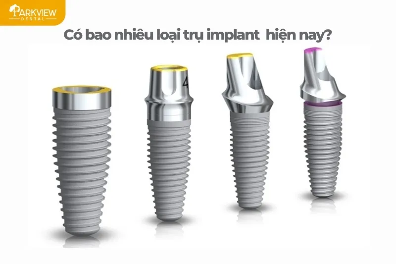 Có bao nhiêu loại trụ implant hiện nay?