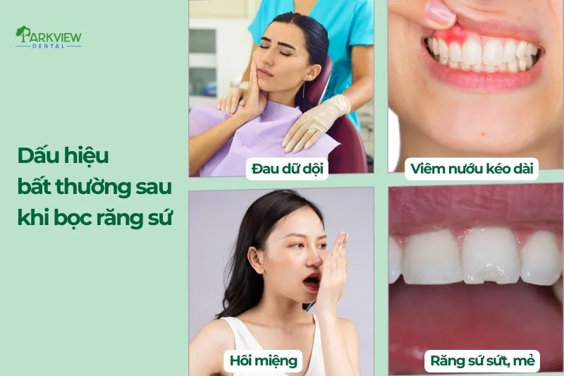 Dấu hiệu bất thường sau khi bọc răng sứ