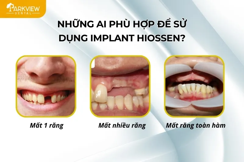 Đối tượng phù hợp sử dụng trụ Implant Hiossen