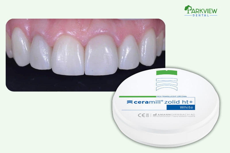 Dòng Ceramill Zolid