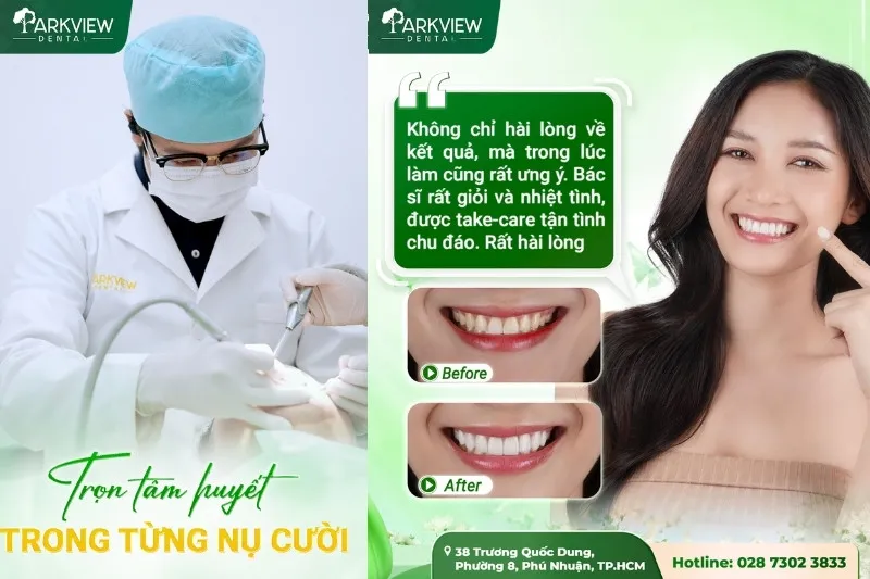 Feedback của khách hàng làm răng sứ tại nha khoa Parkview