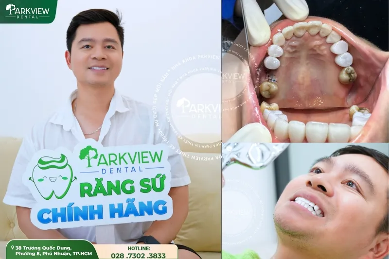 Feedback của khách hàng sau khi trồng răng Implant tại Nha khoa Parkview