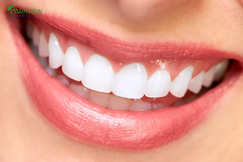 Kiến tạo nụ cười rạng rỡ, răng đều, đẹp, sáng bóng