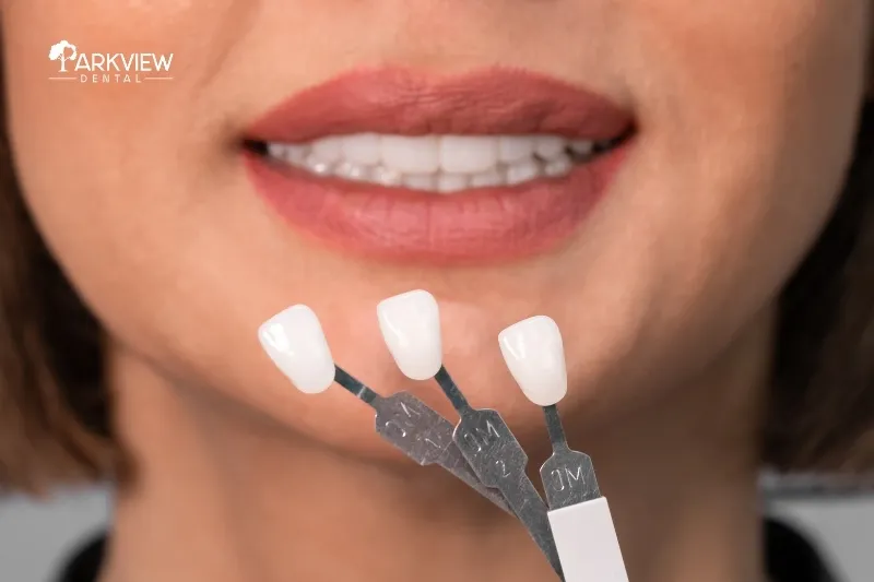 Màu sắc trong mờ tự nhiên của răng sứ Mỹ