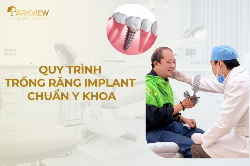 Quy Trình Trồng Răng Implant 5 Bước Chuẩn Y Khoa