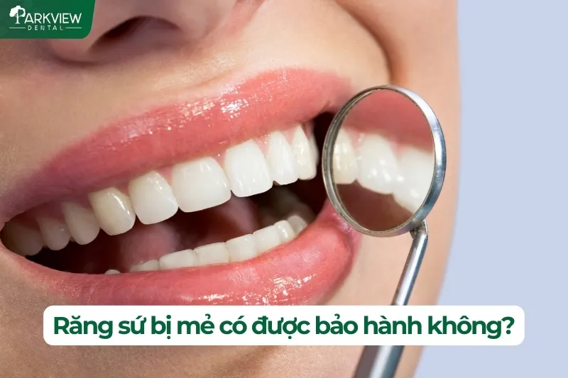 Răng sứ bị mẻ có được bảo hành không?