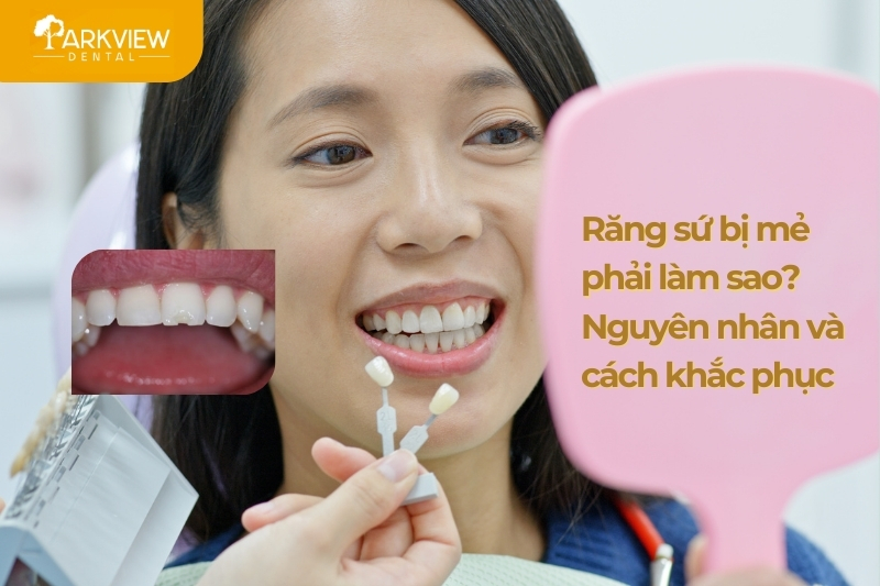 Răng Sứ Bị Mẻ Phải Làm Sao – Nguyên Nhân Và Cách Khắc Phục