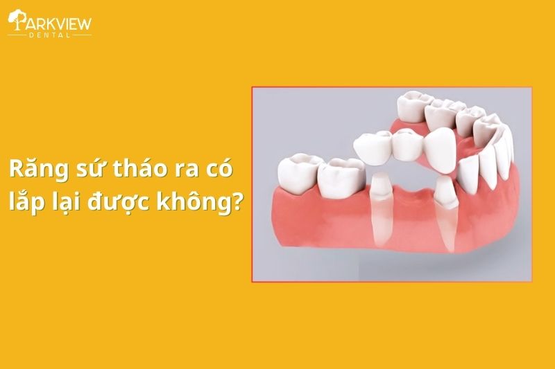Răng sứ tháo ra có lắp lại được không? Có đau nhức không?