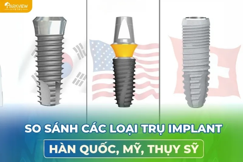 So sánh Implant Hàn Quốc với Implant Thụy Sĩ và Mỹ