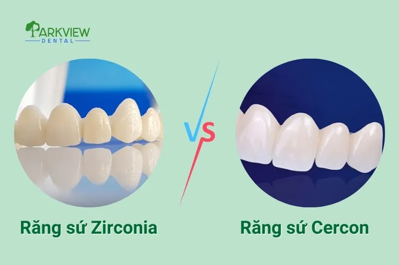 So sánh răng sứ Zirconia và răng sứ Cercon