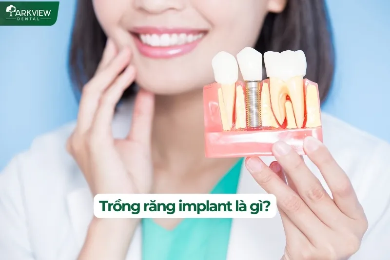 Trồng răng implant là gì?