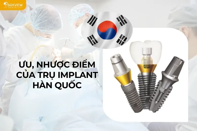 Ưu, nhược điểm của trụ Implant Hàn Quốc